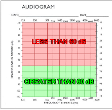 Depiction of hearing thresholds.